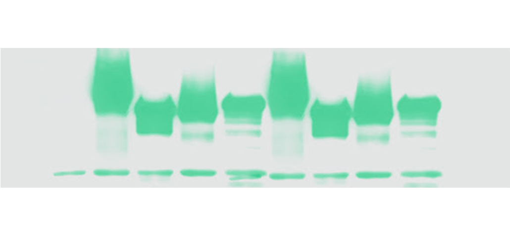 Abcam wide range of protein ladder!